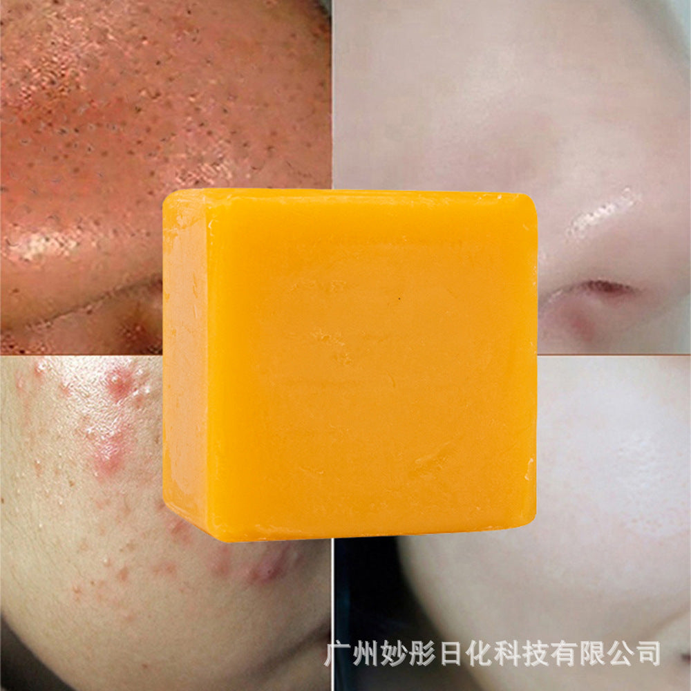 Aromatheraphy Turmeric Soap Handmade Cleansing Bar with Essential Oils